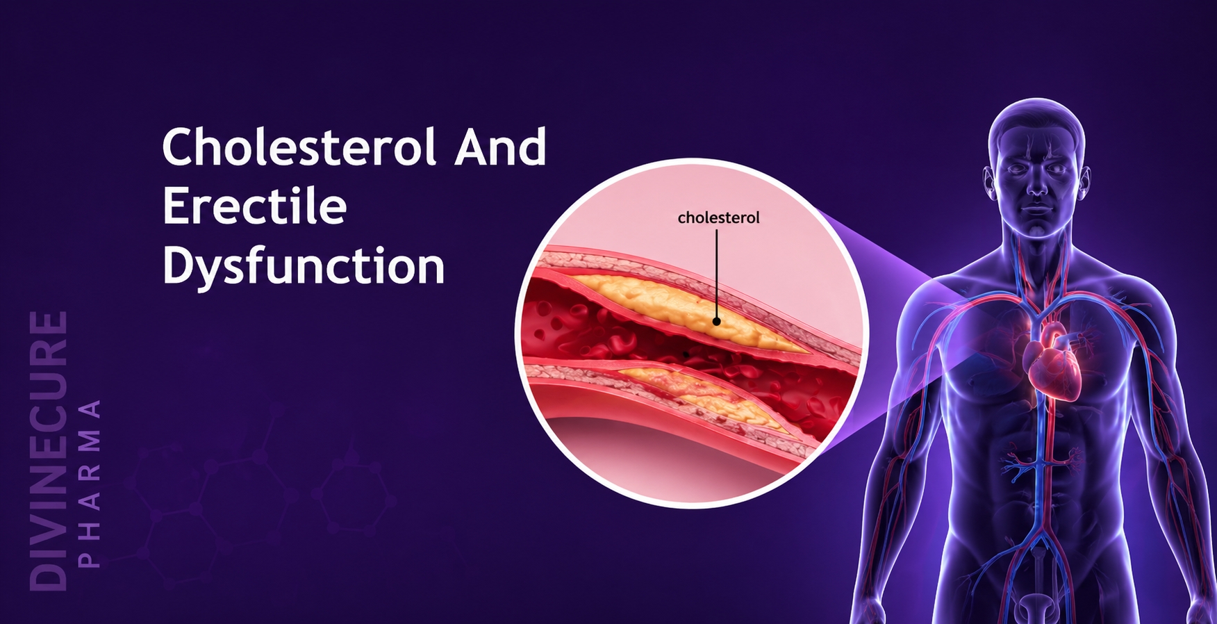 Cholesterol and ED